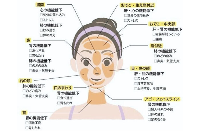 エステ　東京　白金　ニキビ　不調